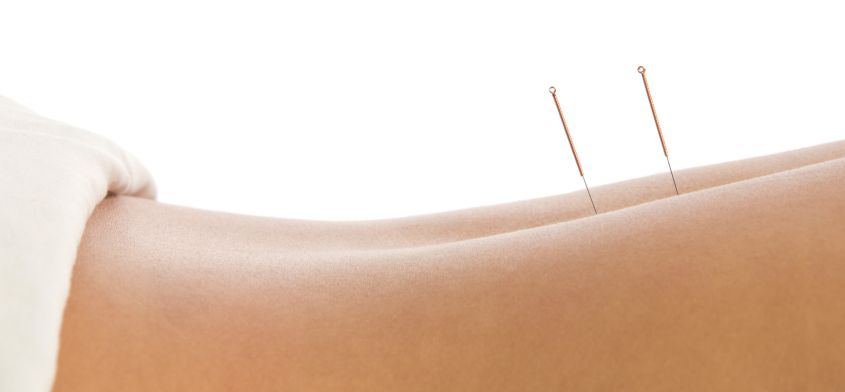 Akupunktura jako sposób leczenia, czyli główne wskazania do stosowania akupunktury